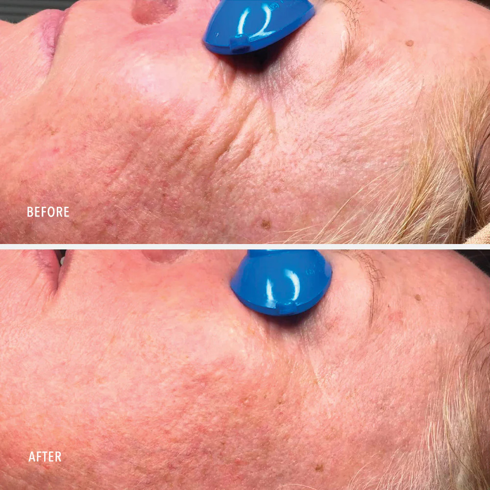 Зволожувальний ліфтинг-крем з ретинолом HydroPeptide Collagen ReActivate PM